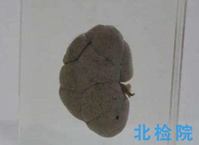 人體生物樣本測試